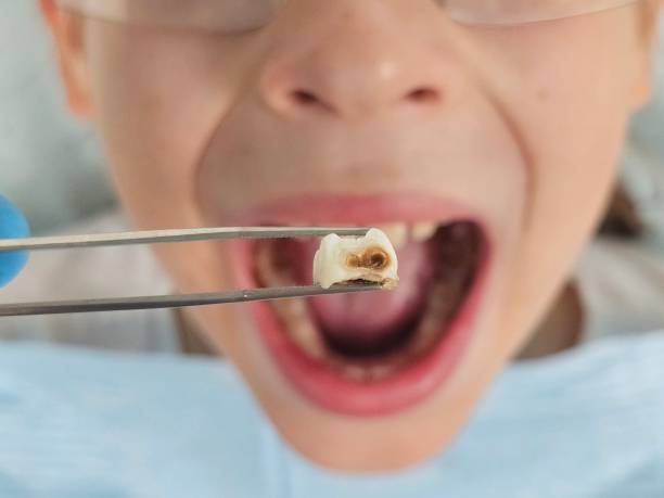 Best Pediatric Emergency Dentist in Hillsboro, OH